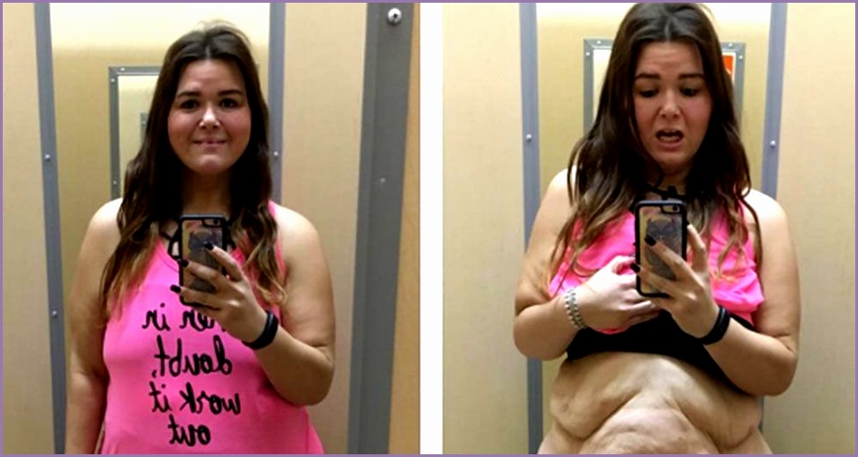woman shares honest photos 180 pound weight loss